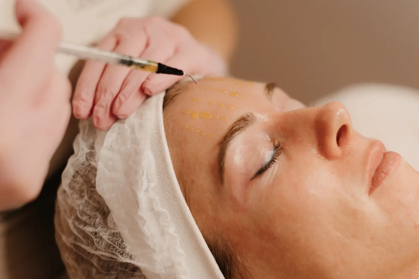 Bio RePeel behandeling bij Delica Derma