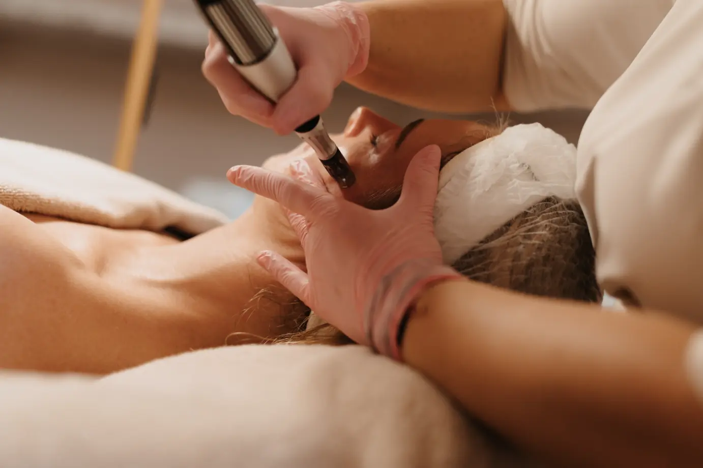 Microneedling behandeling bij Delica Derma.